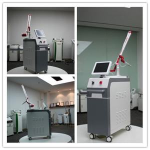 532nm 1064nm 1320nm Laser Pigments Tattoo Removal Laser Treatment Q Switch Nd Yag Laser