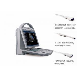 China Portable Pregnancy Ultrasound Scanner with Abdominal Convex Transvaginal Transducers supplier