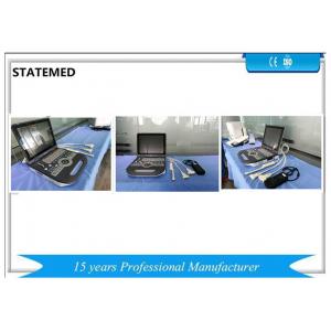 Human Color Doppler Ultrasound Scanner With 80 E / 128 E High Definition Image