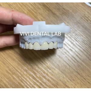 Layered Dental Zirconia Crown And Bridge Translucency 3D PRO