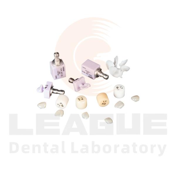 E.MAX Inlay Onlay Efficient Restorations With CAD / CAM Technology