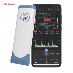 Electronic Linear Array Wifi Wireless Portable Ultrasound Scanner 12MHz