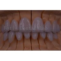 China FDA/ISO/CE Certified Digital Crown Teeth Artificial Crown Any Size on sale