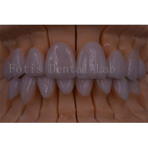 FDA/ISO/CE Certified Digital Crown Teeth Artificial Crown Any Size