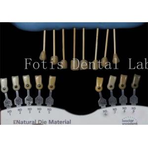 Durable 0.3-0.5mm Thick Dental Lab Veneers Fake Veneers For Teeth
