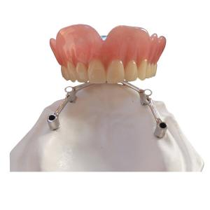 COCR Tooth Implant Crown FDA Dental Implants With Titanium Bar