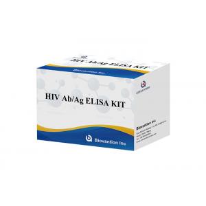 China ISO13485 HIV Ab Ag Test Hiv 4th Generation Assay ELISA Kit 60 Minutes supplier