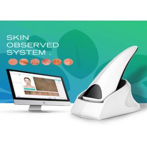 High resolution red color facial skin analyzer machine for skin moisture/wrinkle