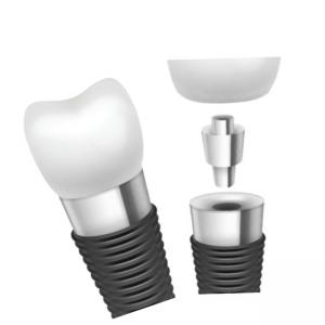 Dental Implant Bars Material Innovation For Superior Performance
