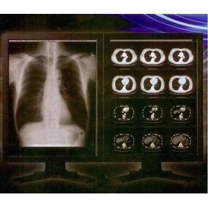 Bright Clear Digital X Ray Film , Konida Medical Laser Transparency Film