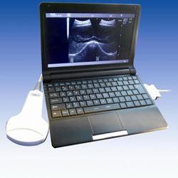 Transvaginal Handheld Ultrasound Scanner With 5 Kinds Of Probe Heads Exchangeabl