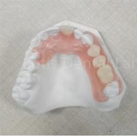 China Pink / Transparent TCS Valplast Odor Resistant Flexible Dental Prosthesis on sale