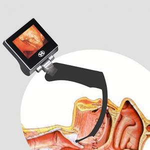 360 Degree LCD Reusable Anesthesia Video Laryngoscope 2 Million Pixel