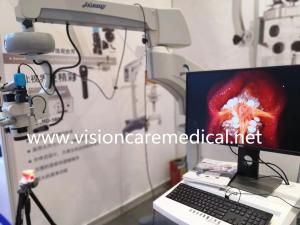 China FDA Marked Ophthalmic Surgical Microscope for Retinal Vitreous Surgery with Live Video System on sale 