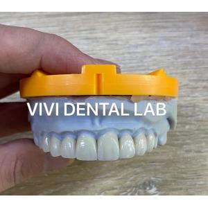 Ivoclar Emax Laminate Veneers Translucent Professional High Level China Dental Lab