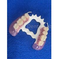 China Stain Resistant Removable Dental Partials Stable Replace Missing Teeth Prosthesis on sale