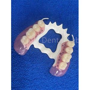 Stain Resistant Removable Dental Partials Stable Replace Missing Teeth Prosthesis