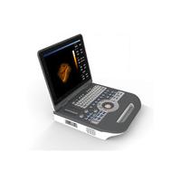 China Medical 4D Color Doppler Ultrasound Equipment Digital Portable Ultrasonography on sale