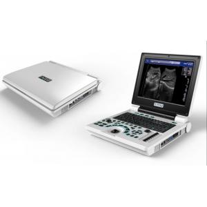 China Laptop USG Machine Portable Ultrasound Equipment USS Scanner supplier