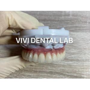 Screw Implant Digital Dental Crowns And Bridge Scheftner Ivoclar Translucency