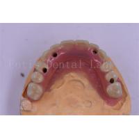 China Dental Implant Titanium Tooth Crown Precision Fit Custom Design on sale