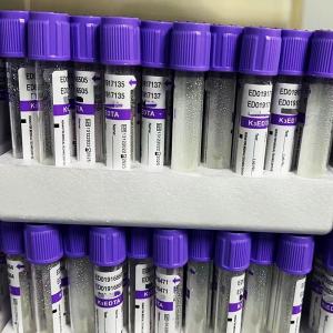 Vacuum EDTA Blood Sample Tube 12/18 Racks Per Carton 3.2mg/ml Additive