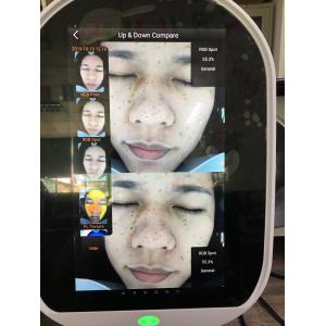 Usb Intelligent Skin Scanner Analysis Magic Mirror System M9 Molde