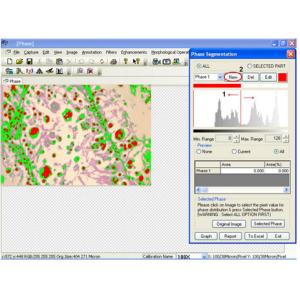 China Software de medição metalúrgico da análise de imagem com detecção de borda on sale