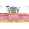 China Sublative RF Machine Innovative Skin Resurfacing And Facial Countour Technology For All Skin Types wholesale