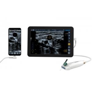 330g Portable Handheld Ultrasound Scanner To Diagnose Peripheral Artery Disease