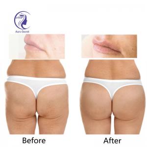 Best Hyaluronic Acid Dermal Filler Injections Image 20 Ml For Buttocks Hip Buy 100ml Mesotherapy Ampoule
