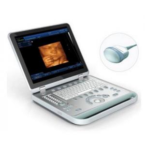 15" Laptop ultrasound machine,4D B/W ultrasound doppler machine with 3.5MHz convex probe