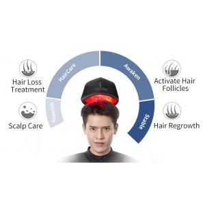 272 LLLT Red Laser Hair Regrowth Cap For For Baldness Hair Loss Treatment