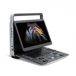Panoramic Imaging SonoScape E2 PRO Portable Ultrasound Machine