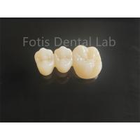 China High Strength Porcelain Layered Zirconia For Long Lasting Dental Bridges on sale