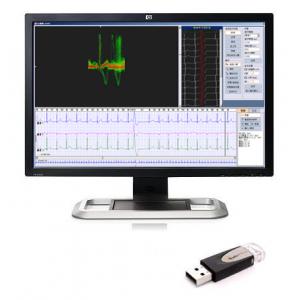 3/12 Channels 24 Hour Holter ECG Workstation Holter Recorder Analysis Software