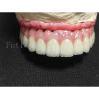 China Titanium / Zirconia Implant Crown Polished Finish Artificial Dental Crown on sale