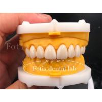 China Fast And Efficient Digital Dental Crowns Size Customization Tooth Implant Crown on sale
