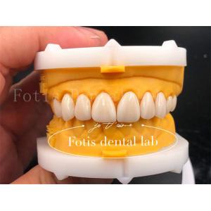 Fast And Efficient Digital Dental Crowns Size Customization Tooth Implant Crown