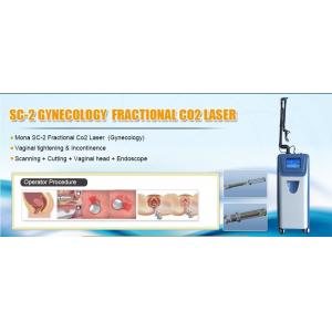 10600nm Fractional CO2 medical Laser of dermatology doctor used for scar removal