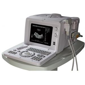 Portable ultrasound doppler,W/B doppler.Ultrasound scanner with convex probe SG218