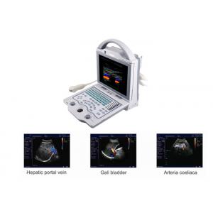 China B Ultrasound Scanner Portable Doppler Ultrasound Machine with Only 4.5Kgs Weight supplier