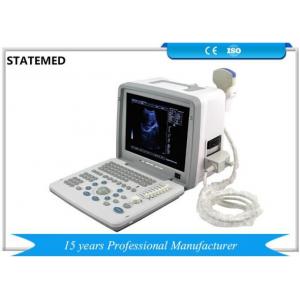 China Gray Portable Ultrasound Equipment , Medical Ultrasound Machine With Probe supplier