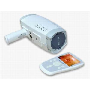 Lens Resolution 800000 Pixels Digital Electronic Colposcope With Automatic Electronic Shutter 3.5 Inch Handheld Screen