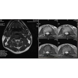 Dry Laser X Ray Medical Imaging For AGFA 5300 / 5302 / 5500 , 35cm x 43cm