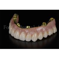 China Full Arch Restoration All On Six Implants Minimally Invasive Solution on sale