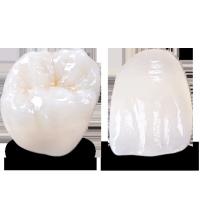 China Emergency Temporary Emax Dental Bridge Teeth Emax Restorations on sale