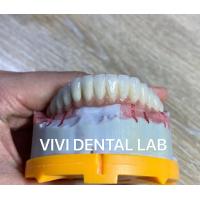 China Digital Cement Dental Bridge Implant Translucency FDA Certified on sale
