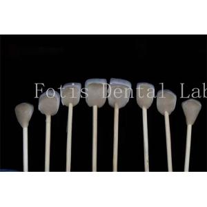 Customizable Dental Lab Laminate Veneers Compatibility with Various Tooth Preparations