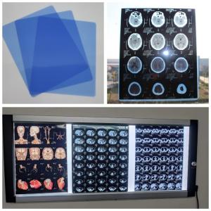 China Blue Base Medical Inkjet Dry Film For Digital X Ray Image With 210microns A3 13x17 supplier